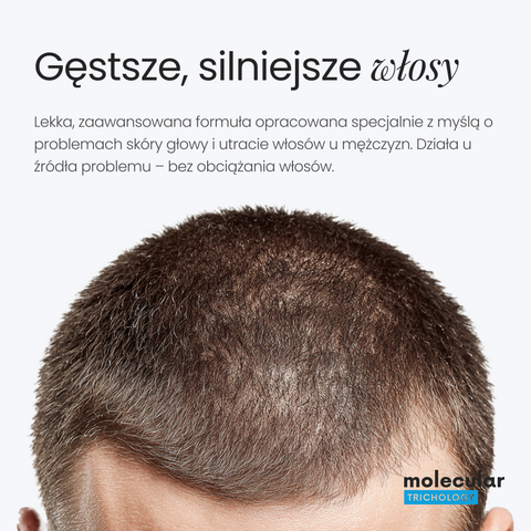 Molecular Trichology - ALPHA For Men - Lotion